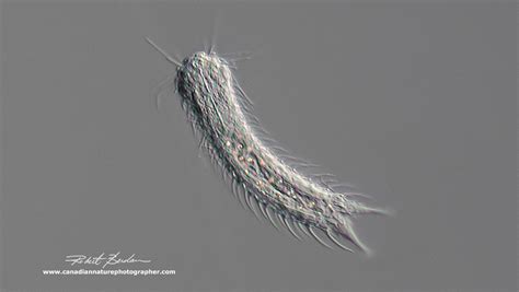  Gastrotrich! These Microscopic Wonders Possess Remarkable Regenerative Abilities and Thriving Communities