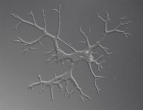  Leptomyxa! A Single-Celled Wanderer With an Incredible Appetite