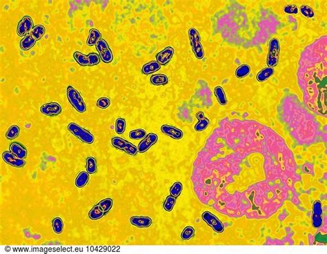  Yersinia Pestis: A Tiny Terror Lurking In The Shadows Of Mammalian Bloodstreams!