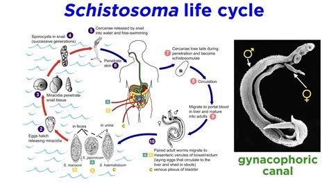 Zoogonus: A Trematode That Makes Its Home in Marine Mammals' Intestines!